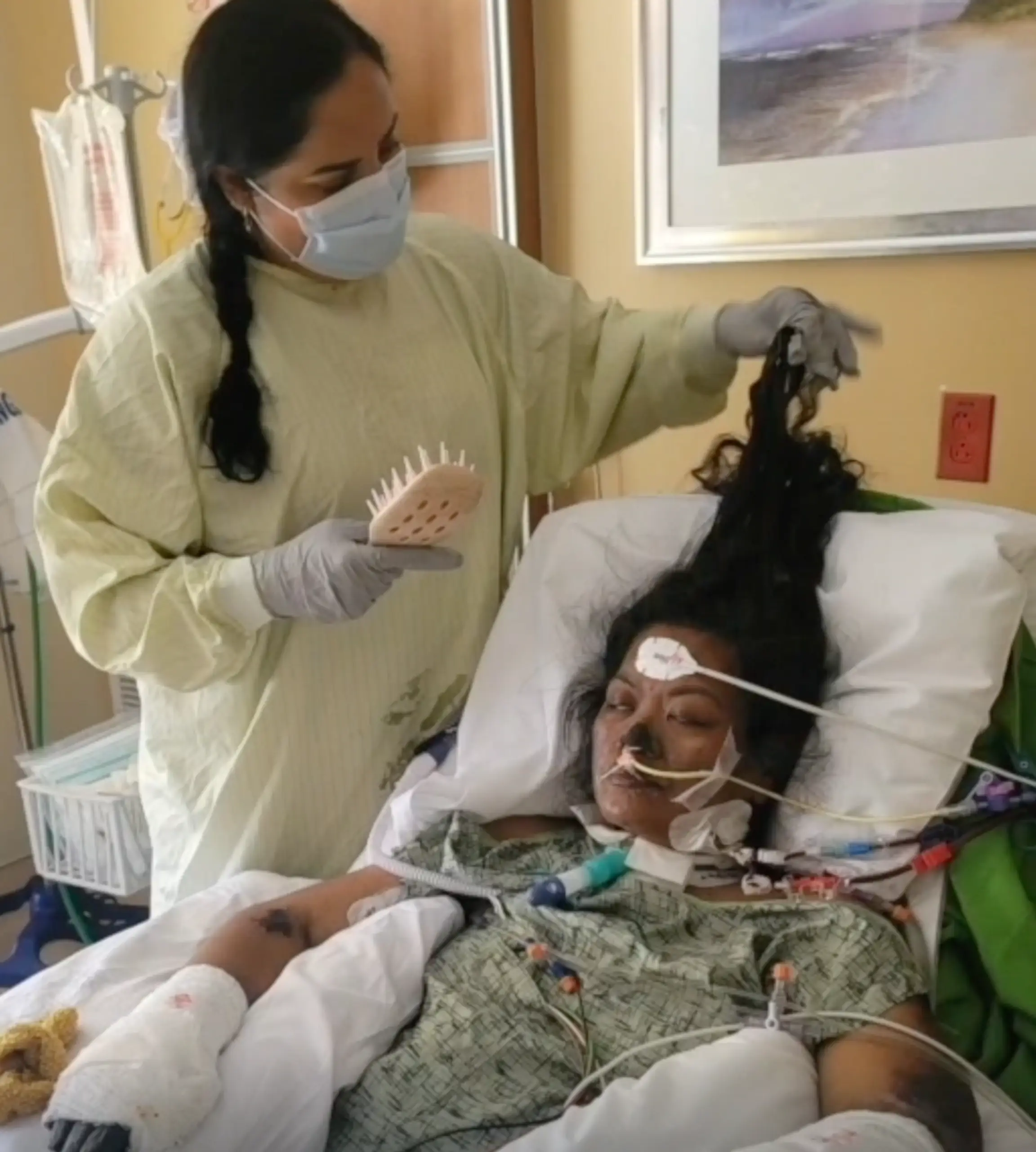Strength athlete loses all four limbs after routine heart checkup uncovers deadly tear